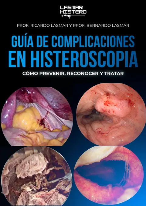 Portada de la Guía de Complicaciones en Histeroscopia
