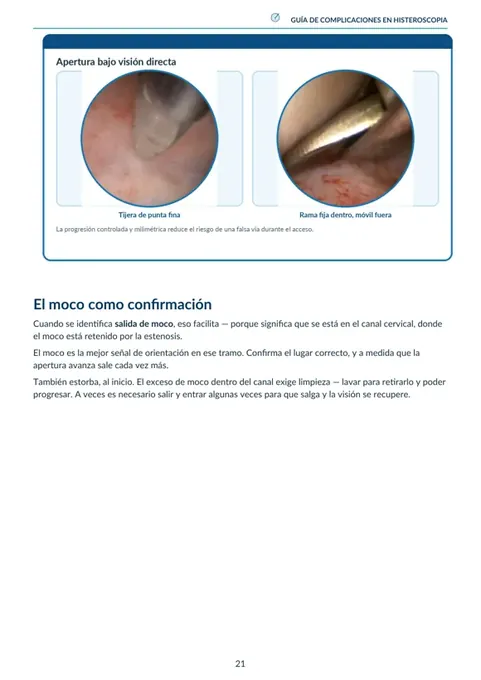 Página de la guía con imágenes histeroscópicas de referencia